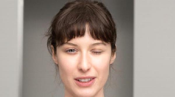 Tu știi ce este miastenia gravis? Află de aici cum poți recunoaște manifestările afecțiunii autoimmune