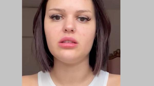 O tânără din Marea Britanie s-a trezit cu un accent ciudat, după o migrenă: Doctorul a fost uimit!