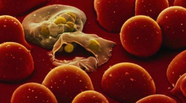 Avertismentul ministrului Sănătății: Sunt 9 cazuri de malarie în România. Atenție, boala poate fi confundată cu o infecție virală!