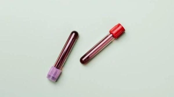 Un singur test de sânge, 12 tipuri de cancer