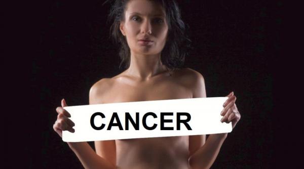 Spania: Ministerul Sănătății confirmă peste 100 de cazuri cancer după implanturi mamare
