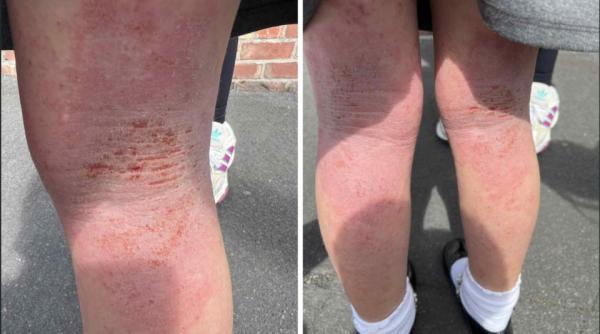 Părinții unor fetițe românce din Anglia, amendați cu 640 lire de școală pentru că le-au dus la doctor în România