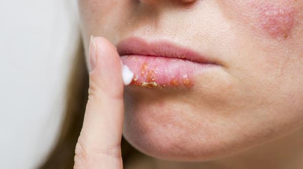 Ingredientul din bucătărie care repară buzele crăpate în câteva minute