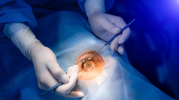 O româncă din Franța a mers la doctor și a aflat că în fruntea sa trăiește un vierme de 11 cm