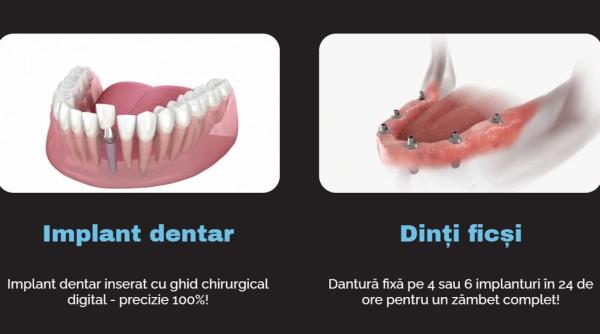 Analiza financiară care trimite diaspora în București pentru implanturi dentare și dantură fixă