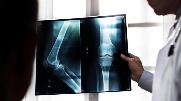 Oamenii de știință au creat un biomaterial inteligent care forțează organismul să își repare singur articulațiile
